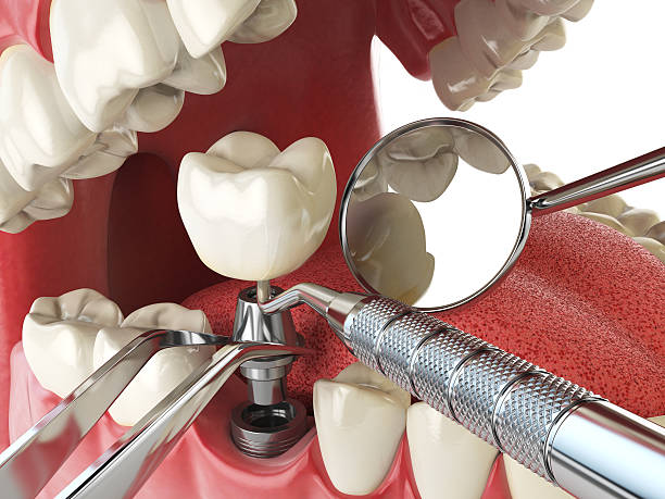 Best Emergency Gum Pain Relief  in Cobden, IL